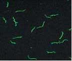 梅毒トレポネーマの顕微鏡写真