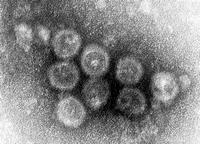 国立感染症研究所 風疹ウイルスの電子顕微鏡写真（加藤茂孝）