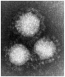 新型コロナウイルスの電子顕微鏡写真：国立感染症研究所