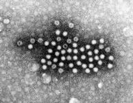 ノロウイルスの電子顕微鏡写真：東京都健康安全研究センター